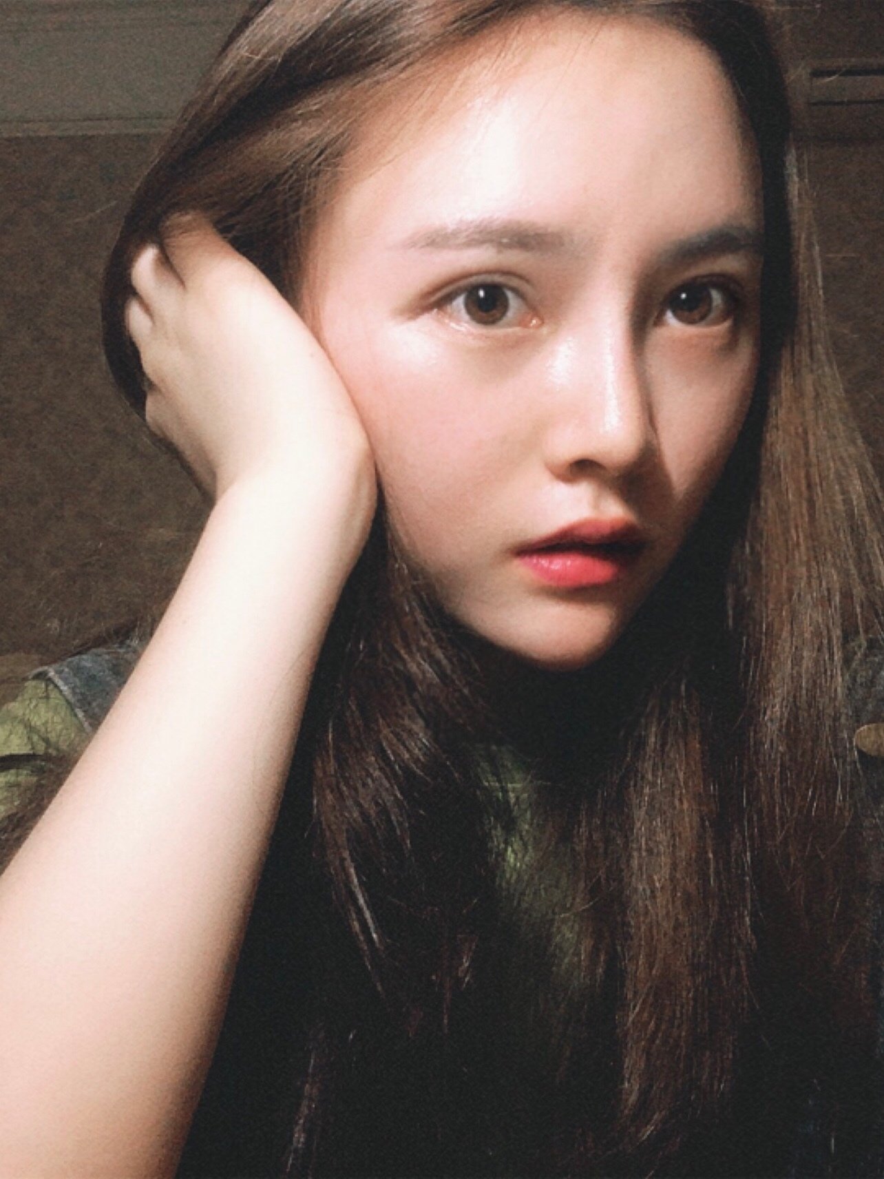 【埋线提升】【6d大v线雕】 脸部线雕 面部提升 线雕小v脸 面部轮廓v