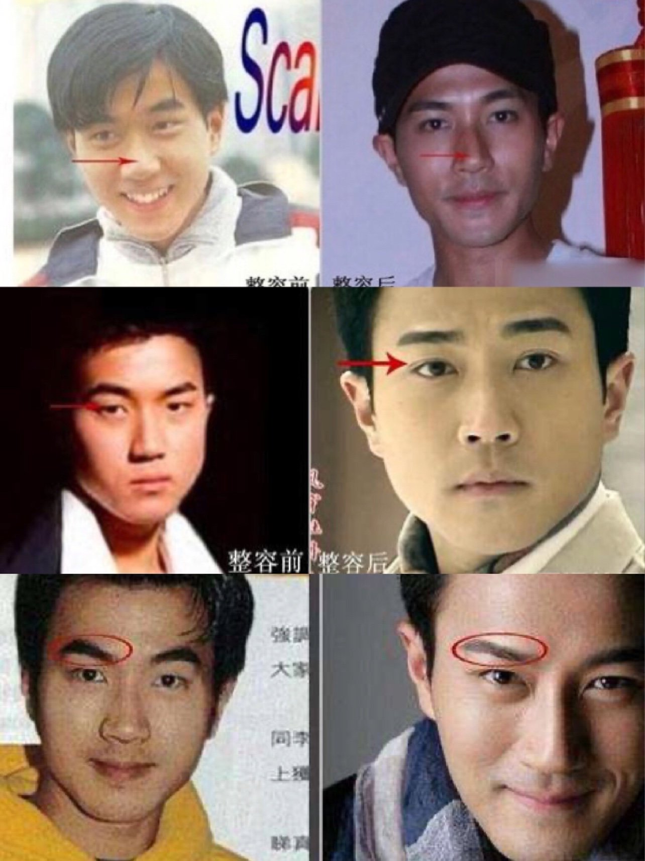 娱乐圈没有不整容的明星,不止女明星会整,男明星当然也有变帅的权利.