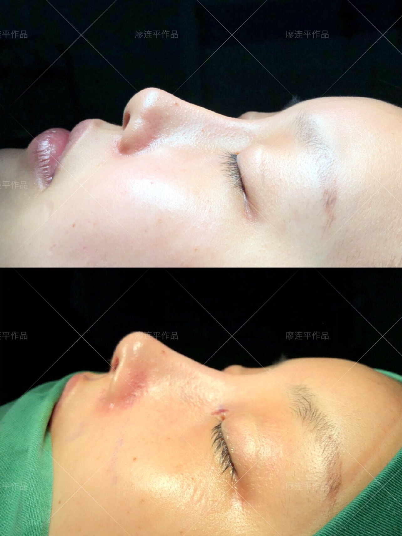 风格多变不局限,气质海鸥线直鼻!