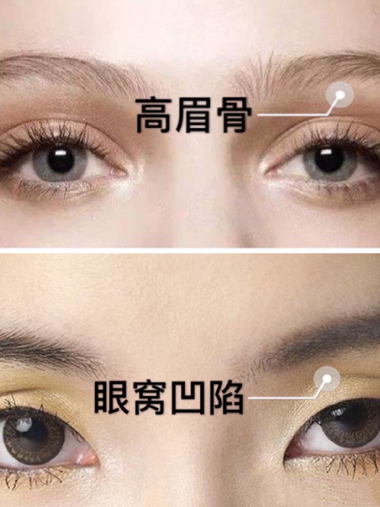 如何分辨是高眉骨还是眼窝凹陷?