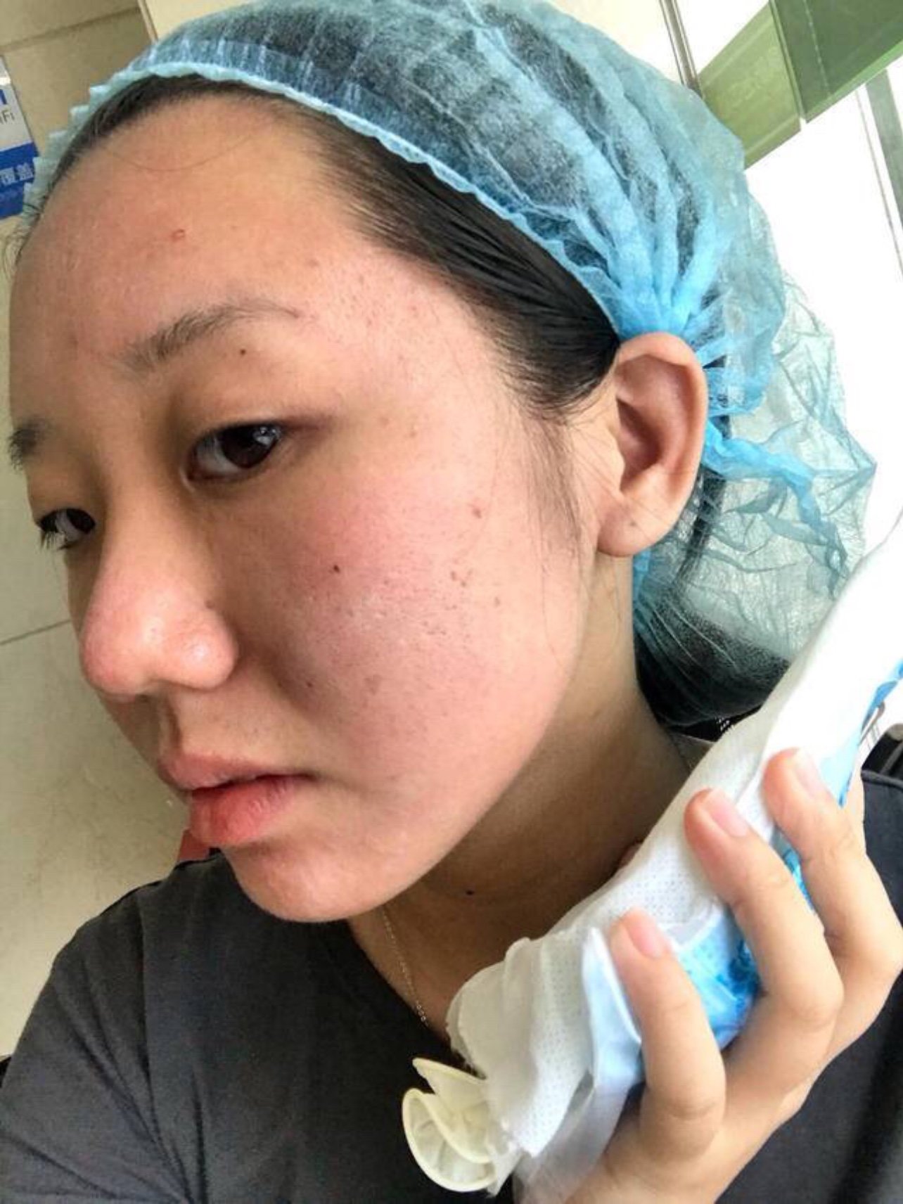 第一次做果酸换肤分享