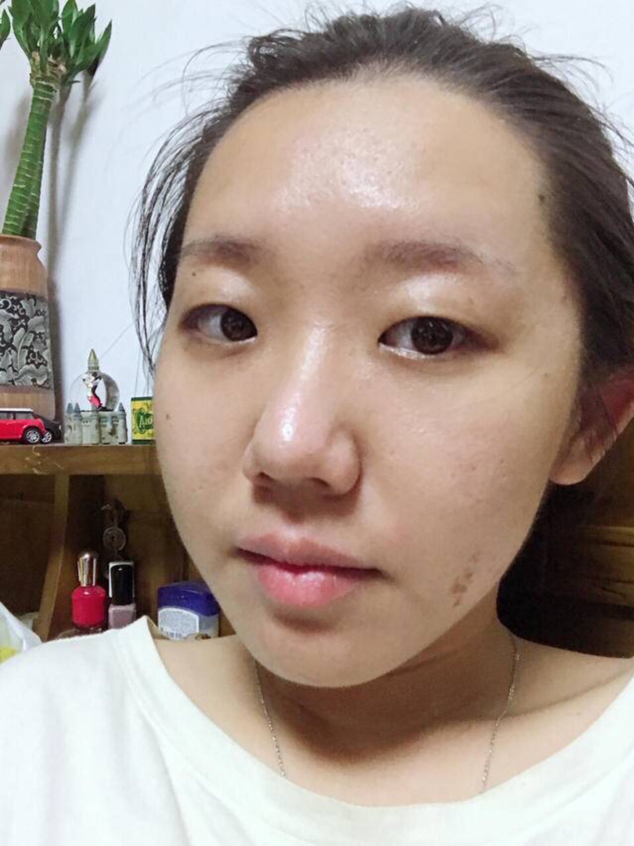 第一次做果酸换肤分享
