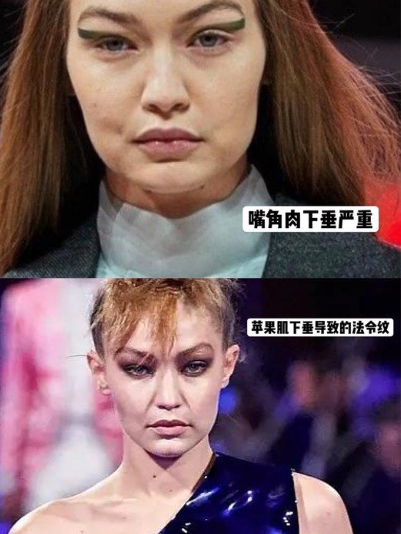 发腮这件事果然是很多人逃避不开的噩梦,不要小看发腮,清爽帅气的