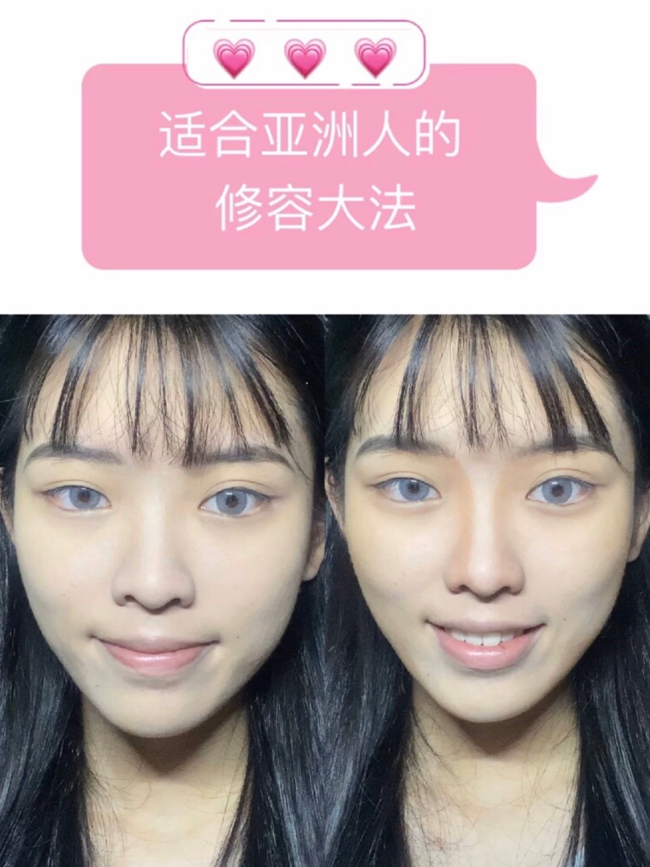 我是那种鼻子不是很高的类_圈子-新氧美容整形