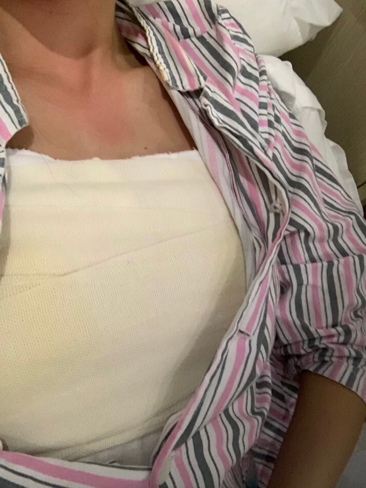 我相信我的选择是没有错的,看我现在的效果这么盒厣纱布图片