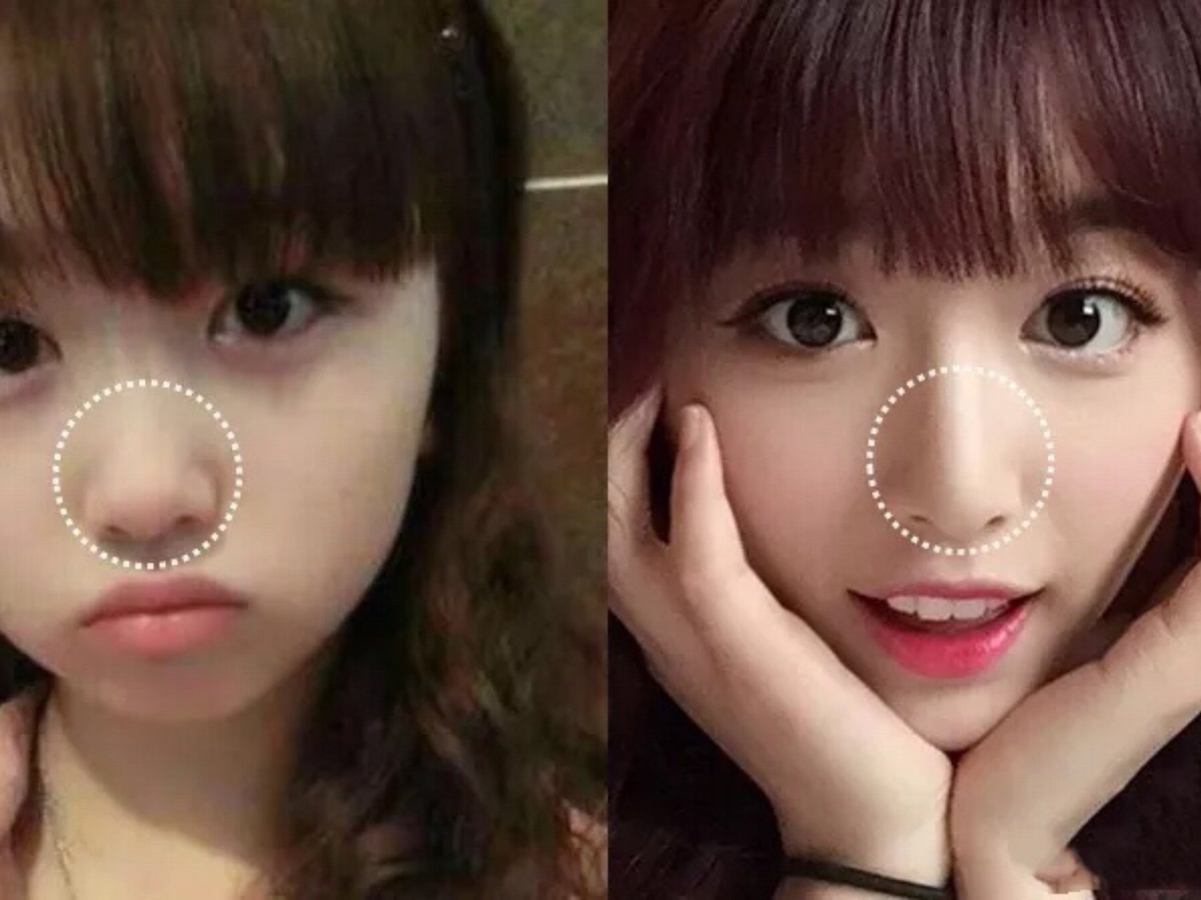 青春有你2里哪些选手是纯天然的孔雪儿做过整形吗