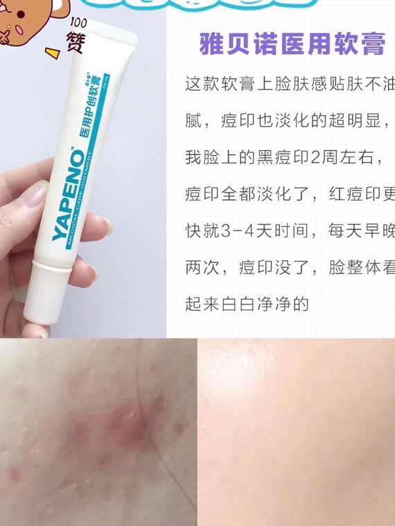 油到可以炒菜的脸既然不油了