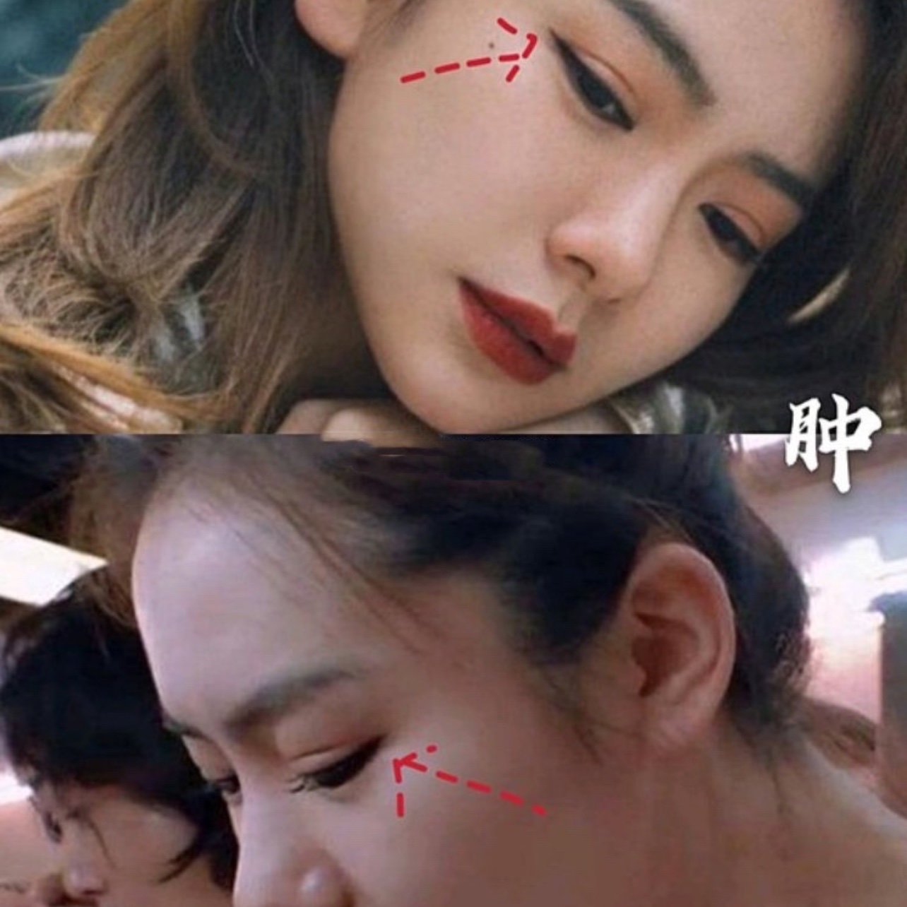 明星割双眼皮哪家强?