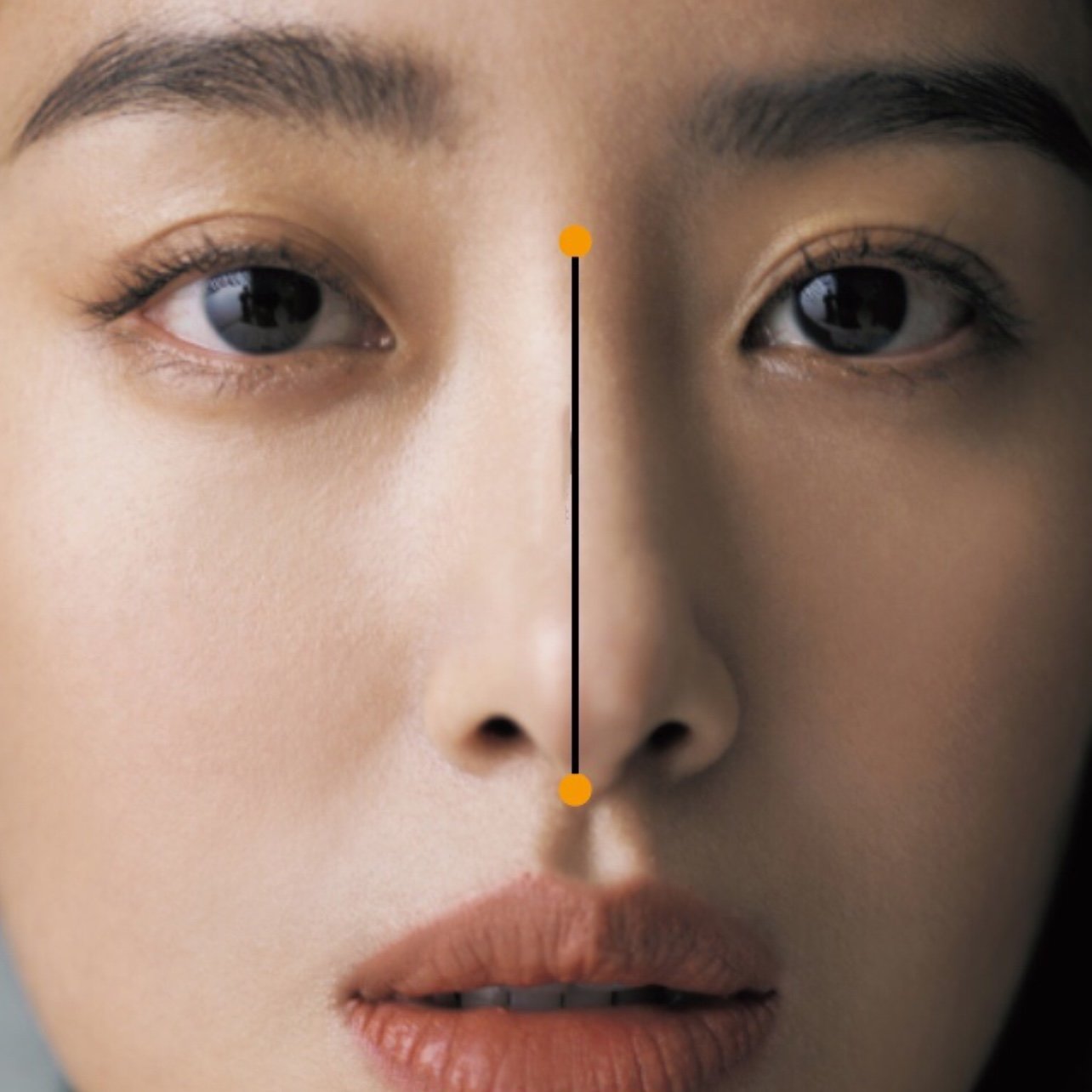 鼻子最合适的长度真的是脸部的三分之一吗?#隆鼻修复