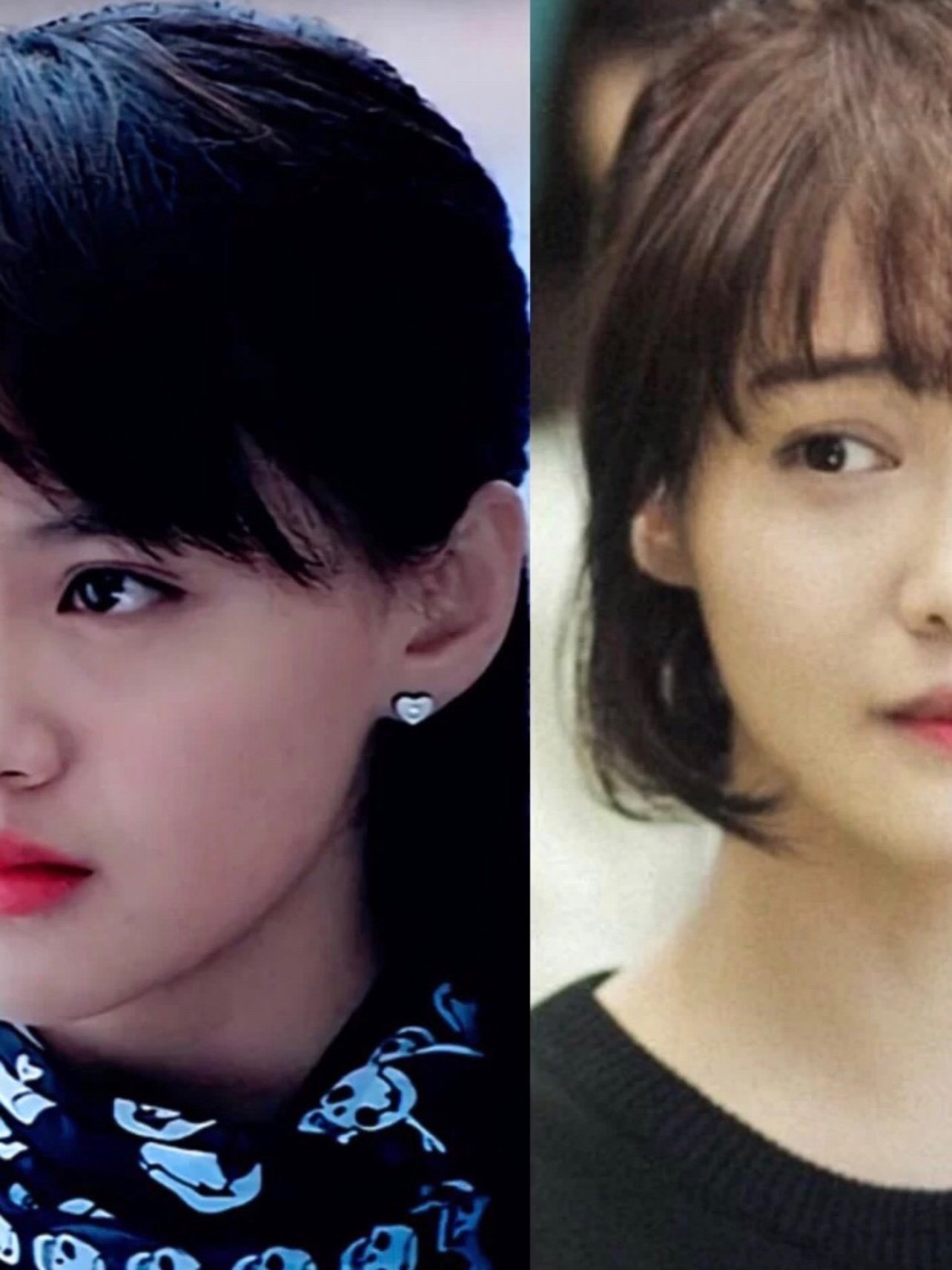 郑爽的泪沟掉到苹果肌了,少女脸是垮了吗?