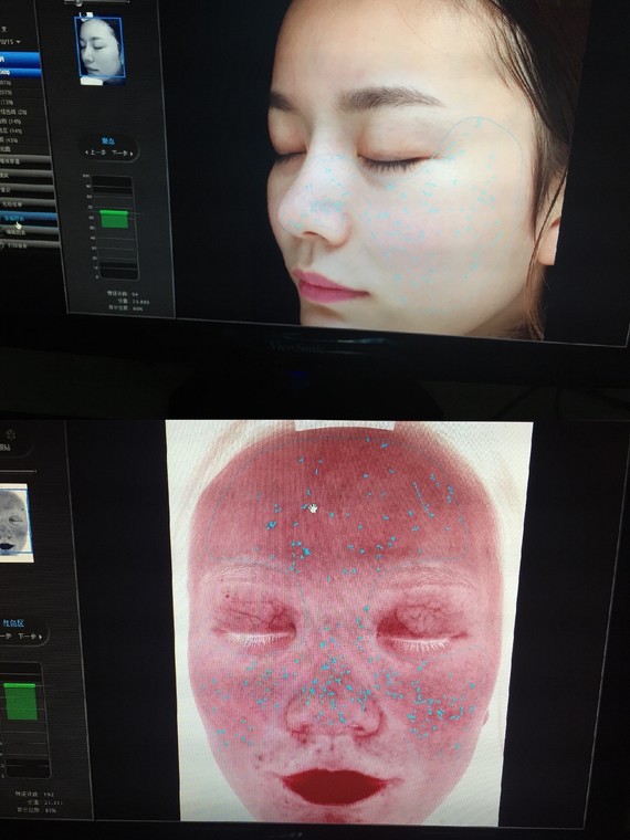 皮肤医生告诉你|visia皮肤检测怎么看