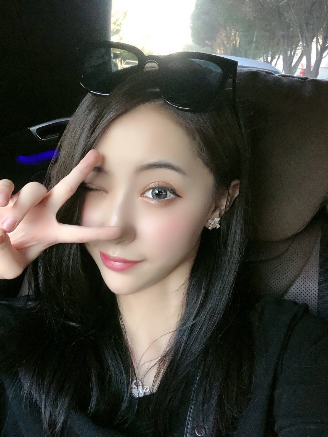 大眼睛bulingbuling~真的超级有神,现在_圈子-新氧美容整形