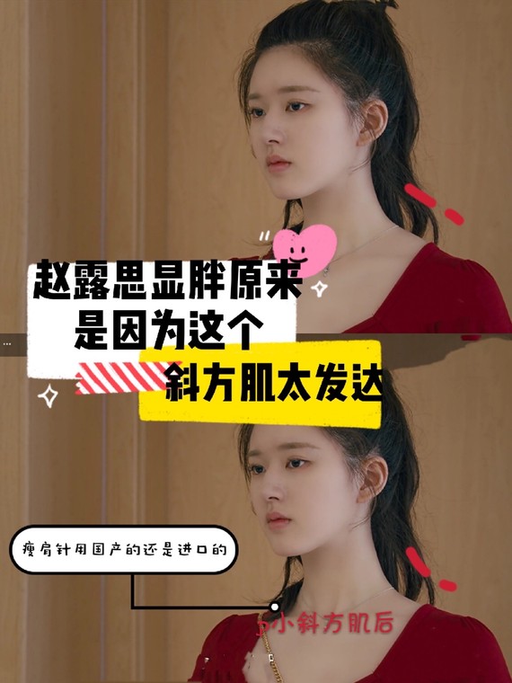瘦肩针最近在看一部电视剧,赵露思在里面演女一号我_圈子-新氧美容