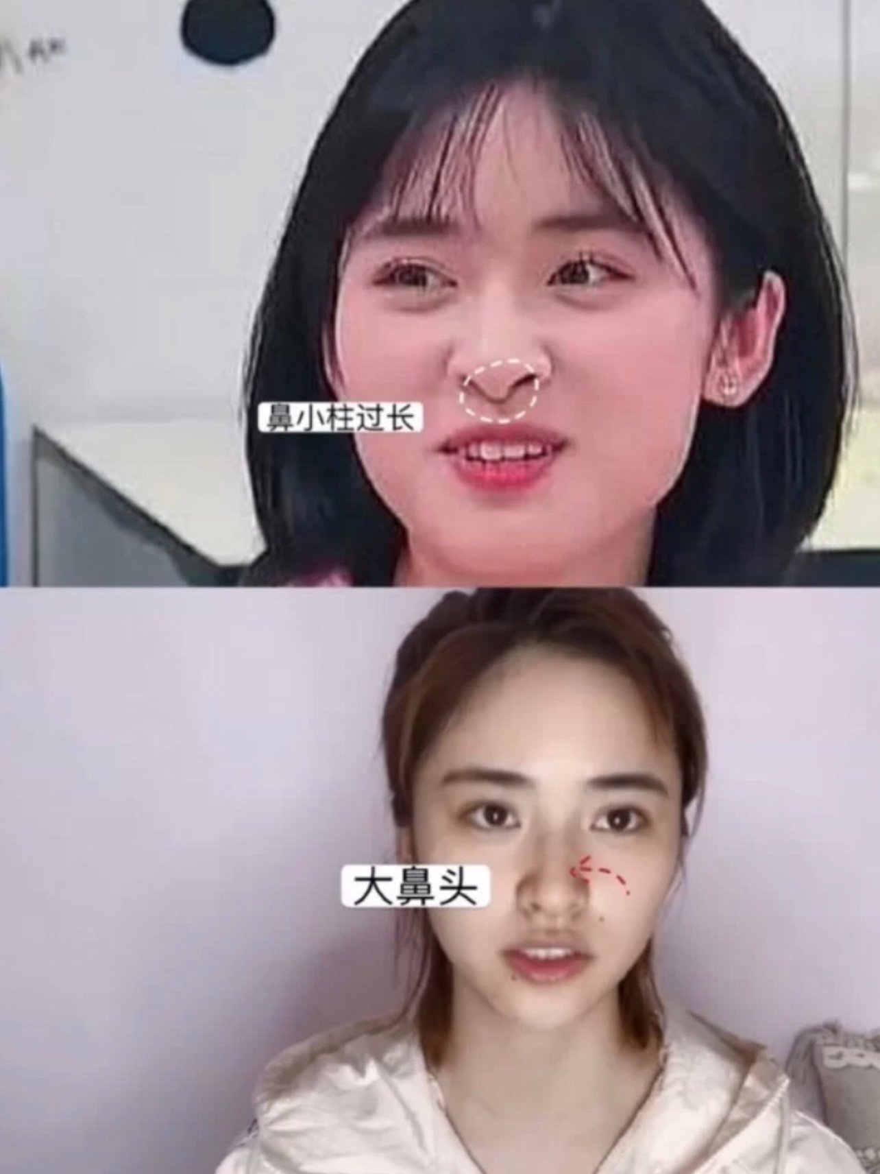 沈月突然变美?偷偷整容还是p图