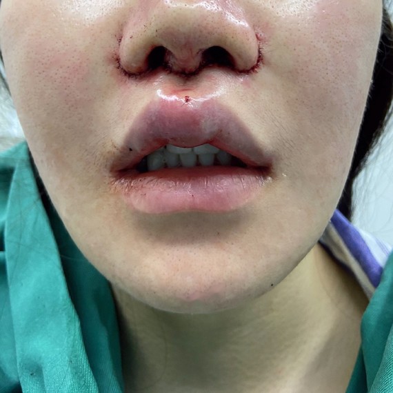 怎么说呢,人总是会因为年轻做了一些错误的选择和决