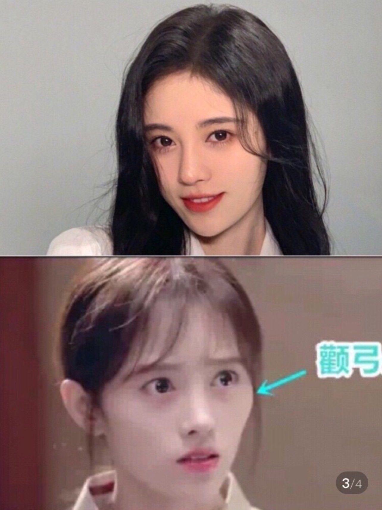 四千年美女变美之旅踩过的坑,快来看看61鞠婧祎变脸之_圈子-新氧