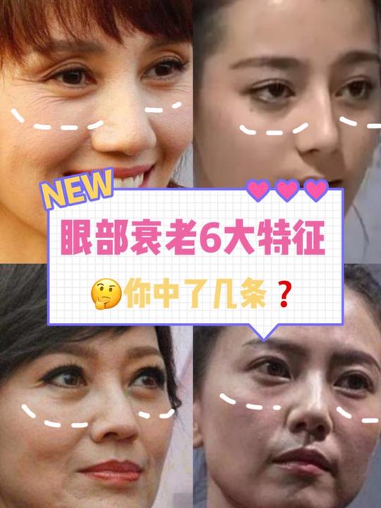 看术前的照片就应该知道我为什么要做手术了吧,我长