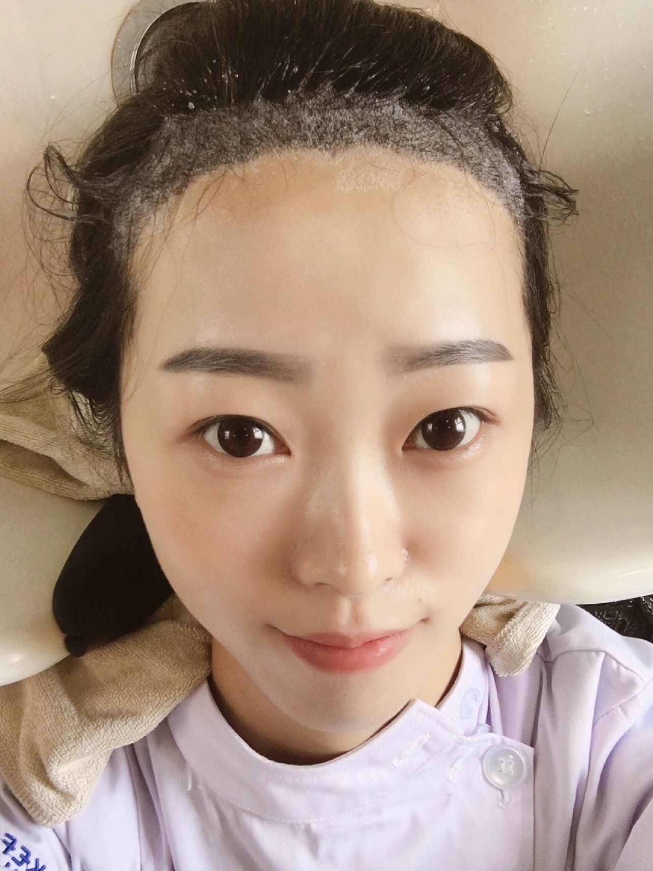 🧏🏼‍♀️🧏🏼‍♀️🧏🏼‍♀️大麦微针植