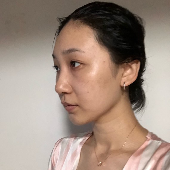 线雕之后的几天我就已经做好了要丑啊丑的心理准备