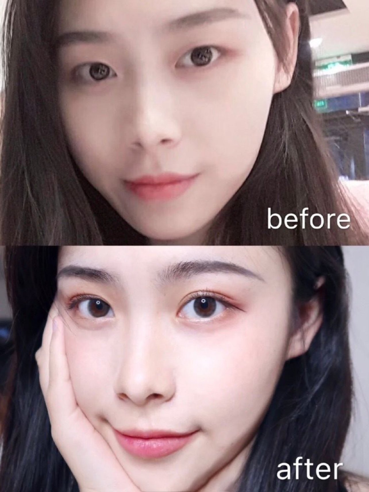 超自然的全切双眼皮