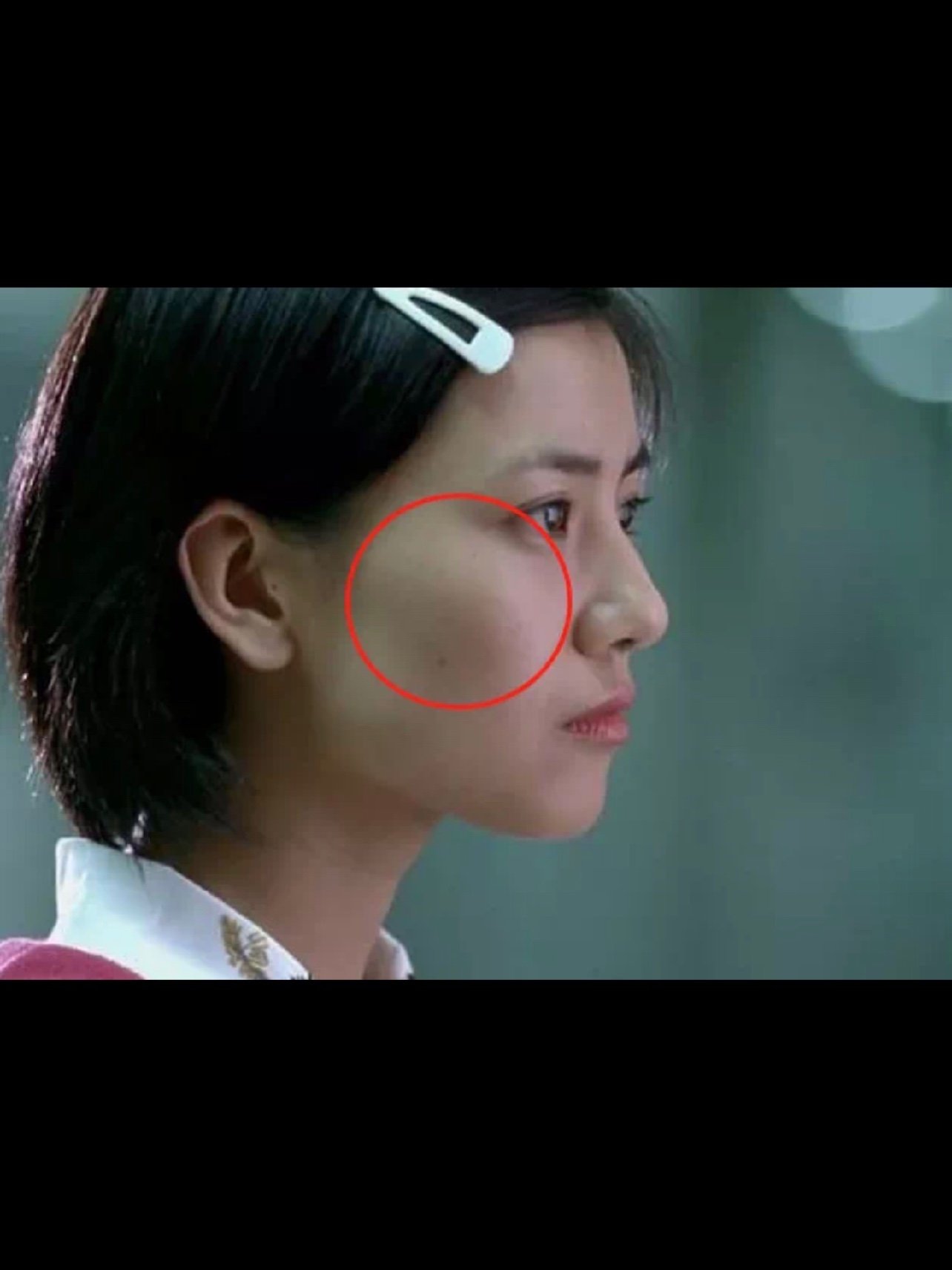 以前高圆圆有明显的颧弓外扩问题