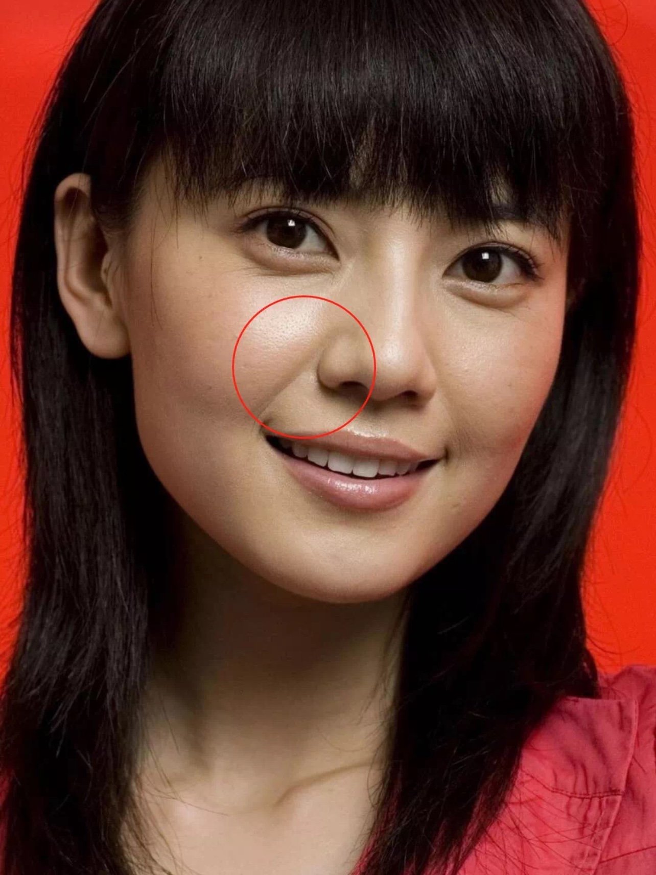 以前高圆圆有明显的颧弓外扩问题.