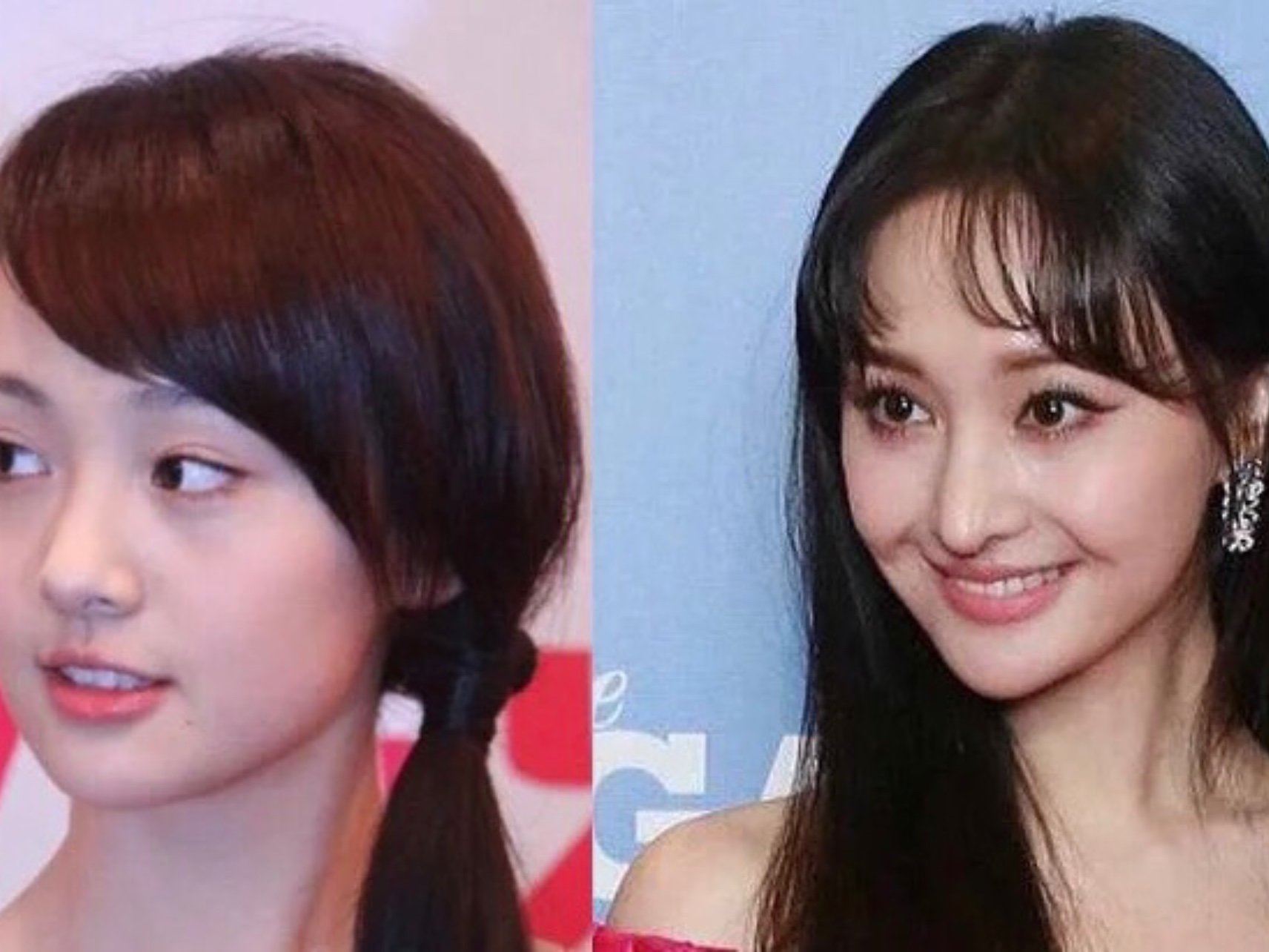 郑爽的鼻子毁了她一张脸.