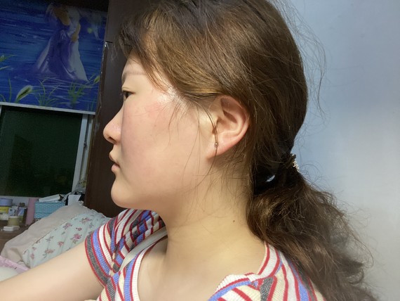 侧面真的鼻子凹进去没鼻子鞋拔子脸吗