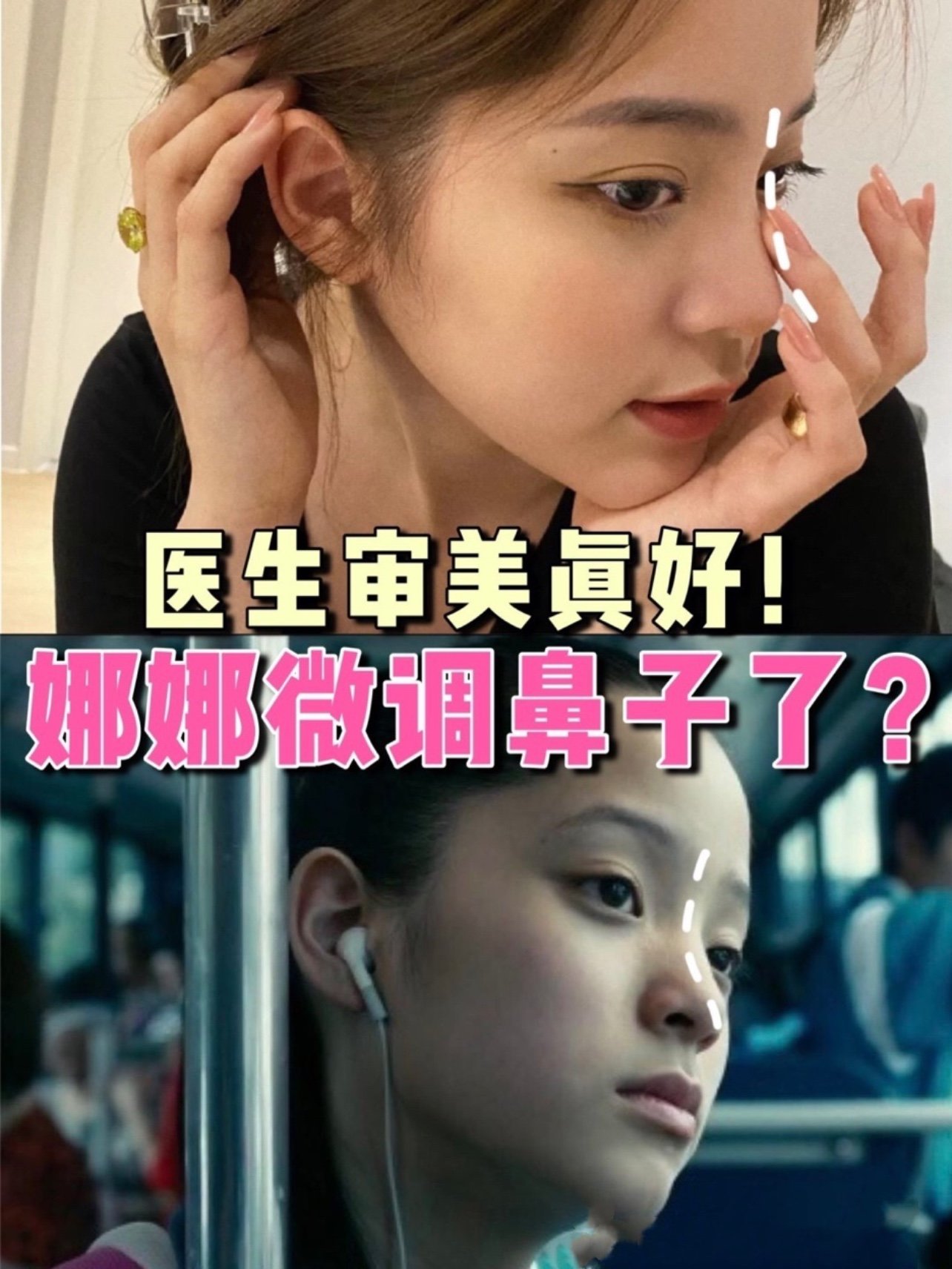 欧阳娜娜微调鼻子了