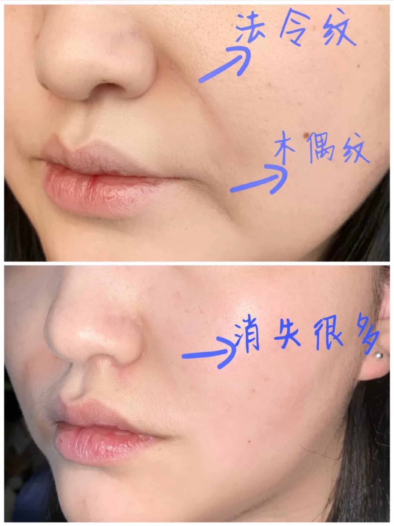 就会发现一个脸像少女,而_圈子-新氧美容整形