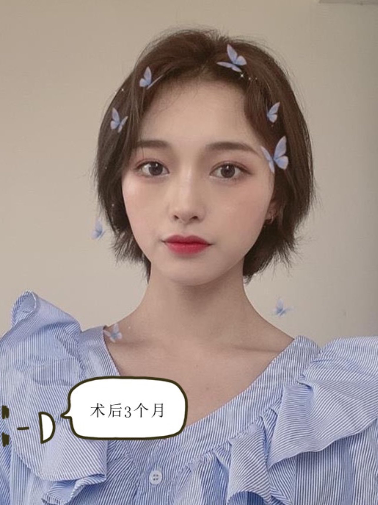 论双眼皮类型,那种更适合你!