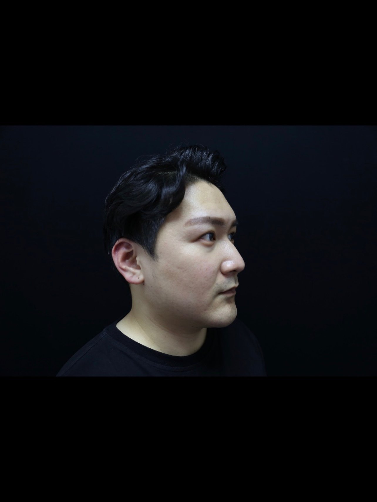 有很多朋友问我鼻子那么高了还去做鼻子干什么,但是鼻_圈子-新氧美容