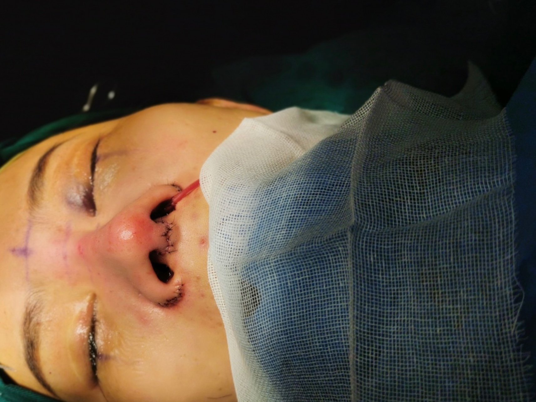 什么流程了,所以紧张感不                    鼻子做的自己不满意