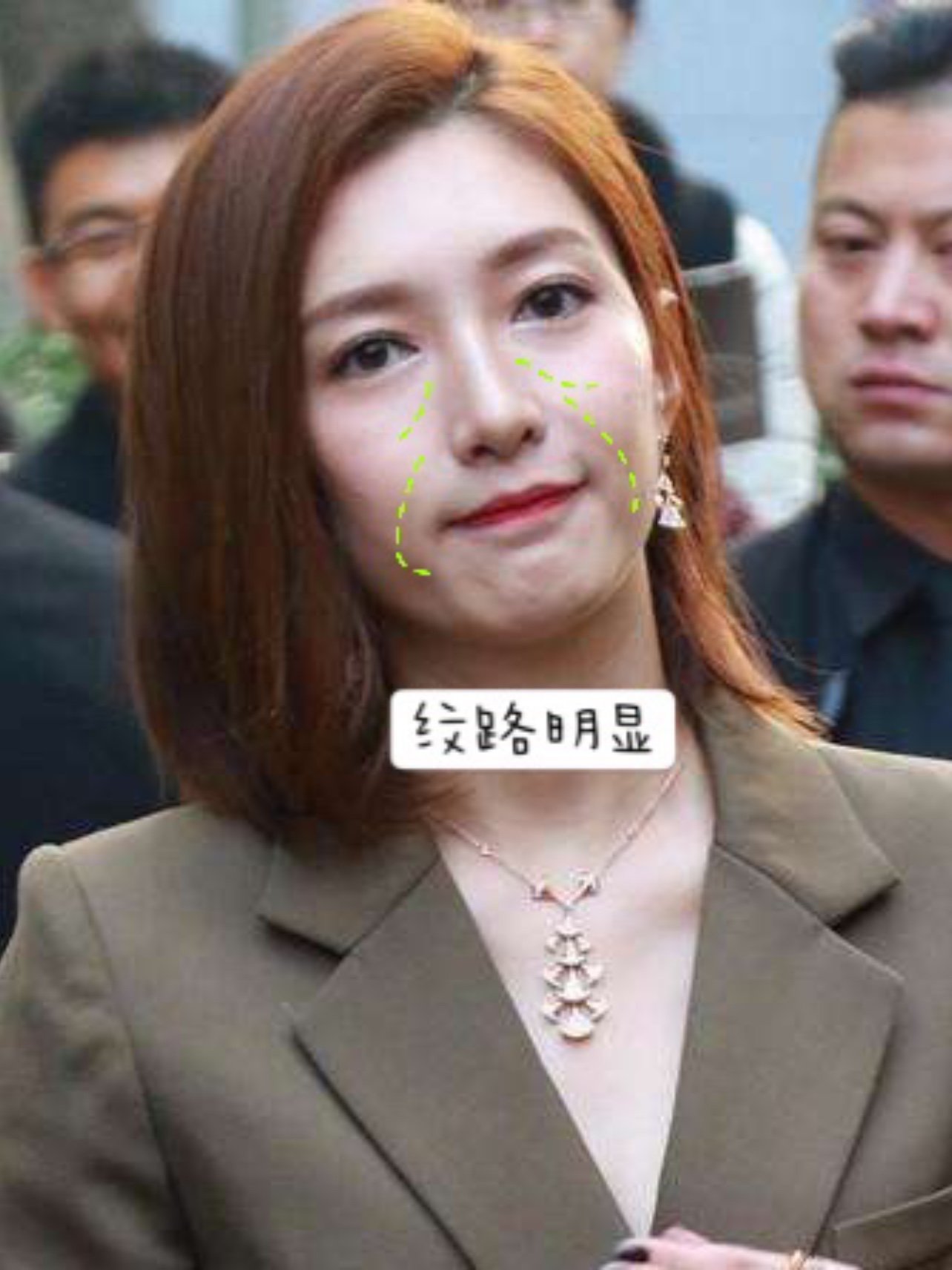 90看到很多人说江疏影显老,看了看《30而已》里的她_圈子-新氧美容
