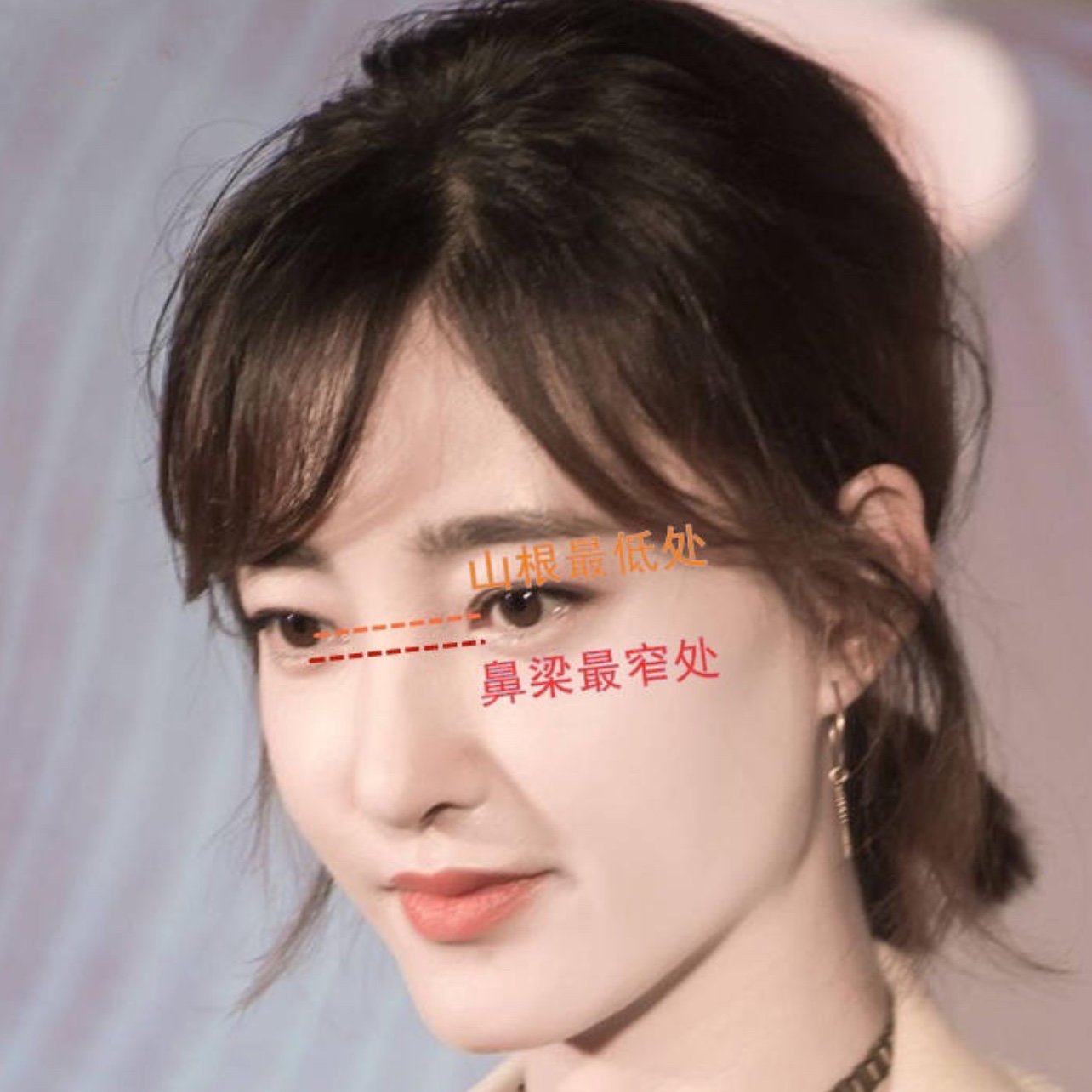 7915宝贝们今天的干货来啦95在隆鼻的时候,山根是非常_圈子