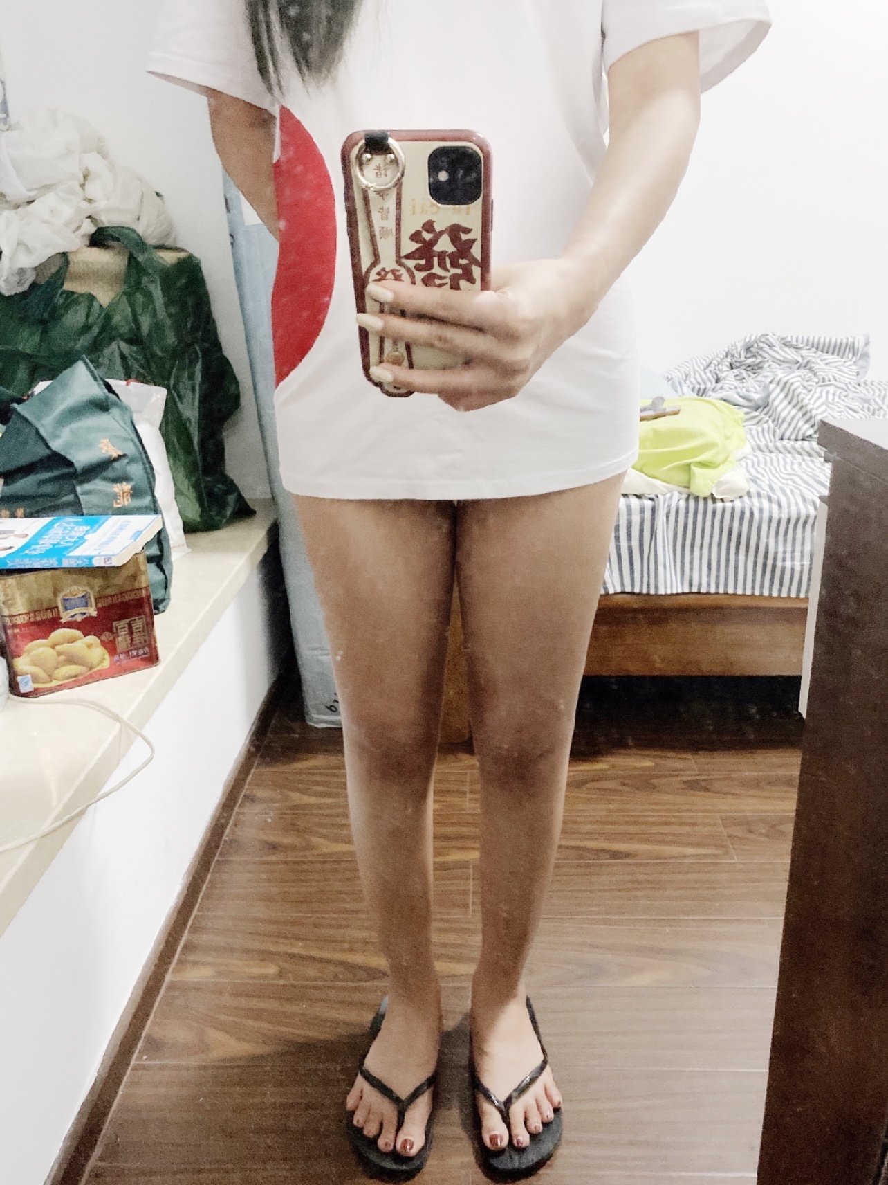 晒出你的"女团腿" 这个世界永远没有丑女人只有不_圈子-新氧美容整形