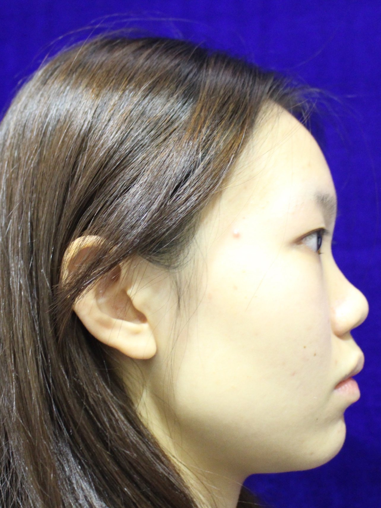 莲雾大家应该都见过吧,自行脑补,没有见过的可以查冶峭吩踩蠖圆鼻子