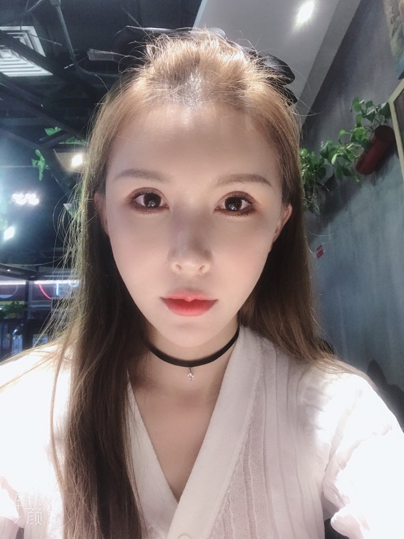 瘦脸针打完15天,效果终于出来了,而且前后一对比真_圈子-新氧美容整形