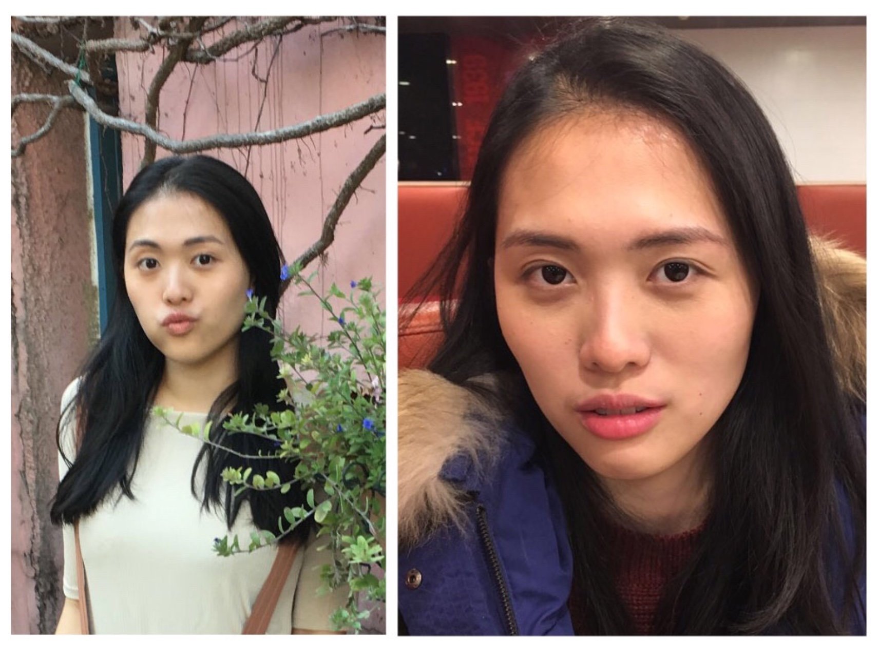 大家都说我脸小好,但我觉得不是脸小就好的,得脸饱满_圈子-新氧美容