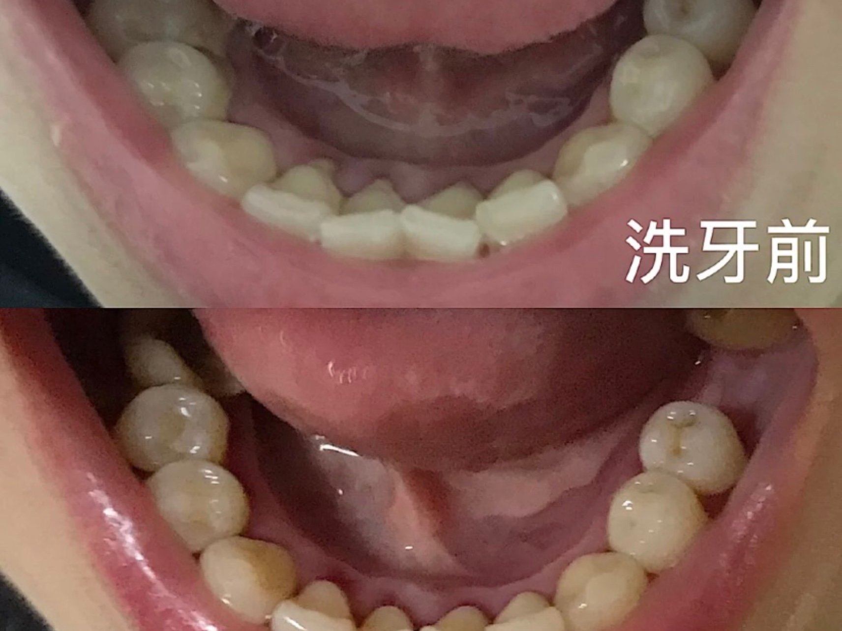 效果比较满意,无额外费用,服务体验很棒