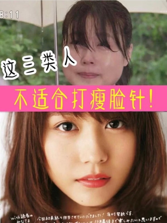 929292打完瘦脸针没效果,可能是因为……90脸颊脂肪层_圈子