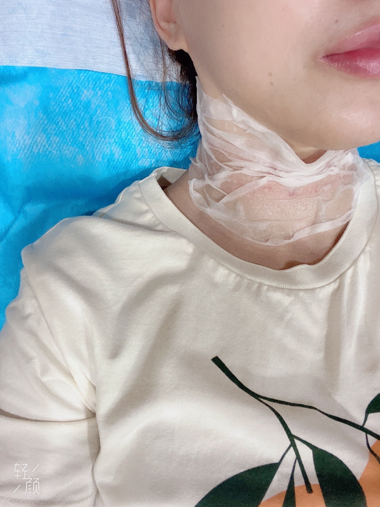 不能让脖子透露年纪今天过来打嗨体水光去颈纹