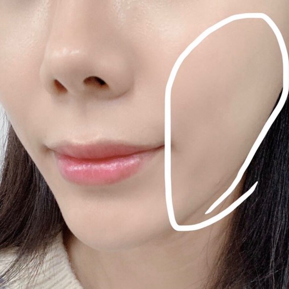 如何让下巴快速消除皱纹(如何让下巴快速消除皱纹小妙招)