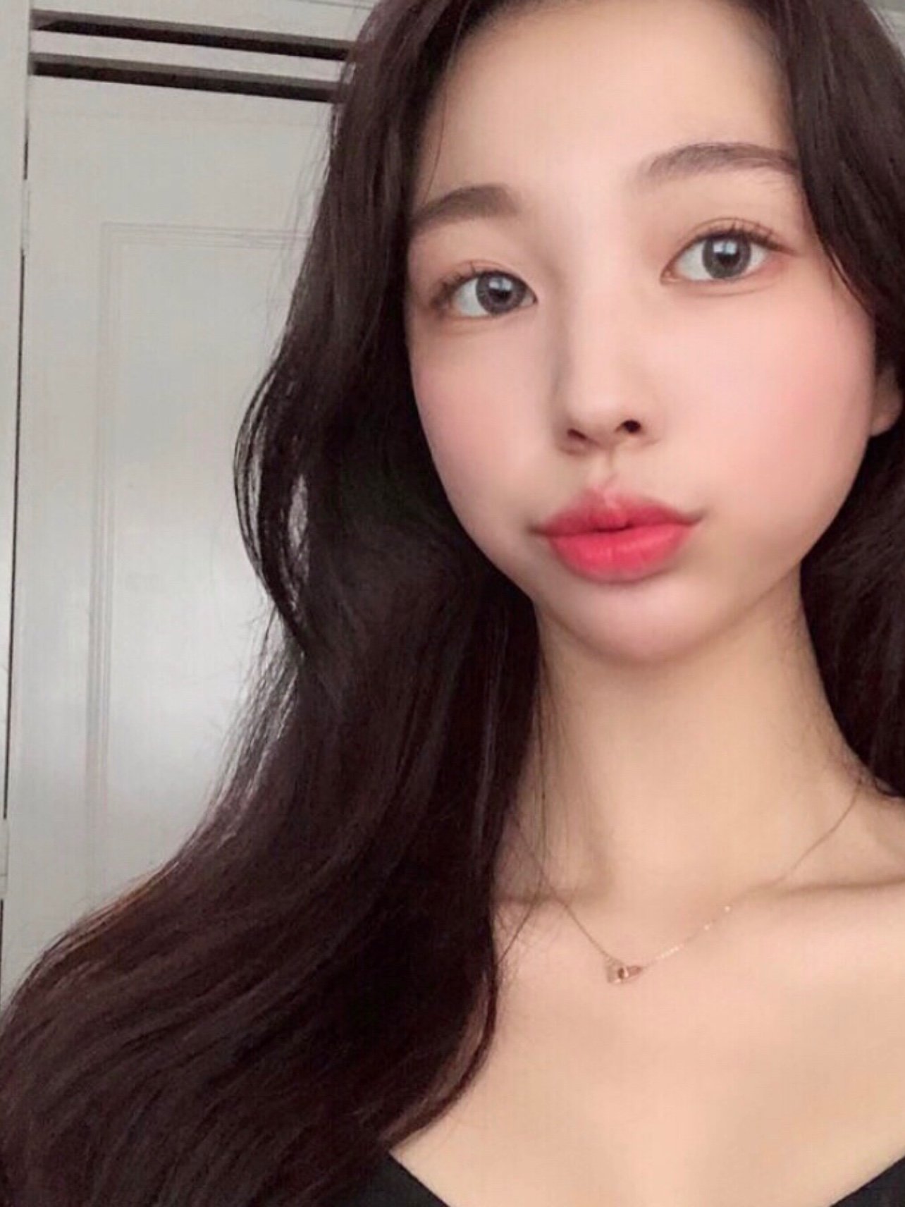 在江南做了玻尿酸丰唇 嘟嘟唇 嘴角,喜欢有唇珠的嘟_圈子-新氧美容