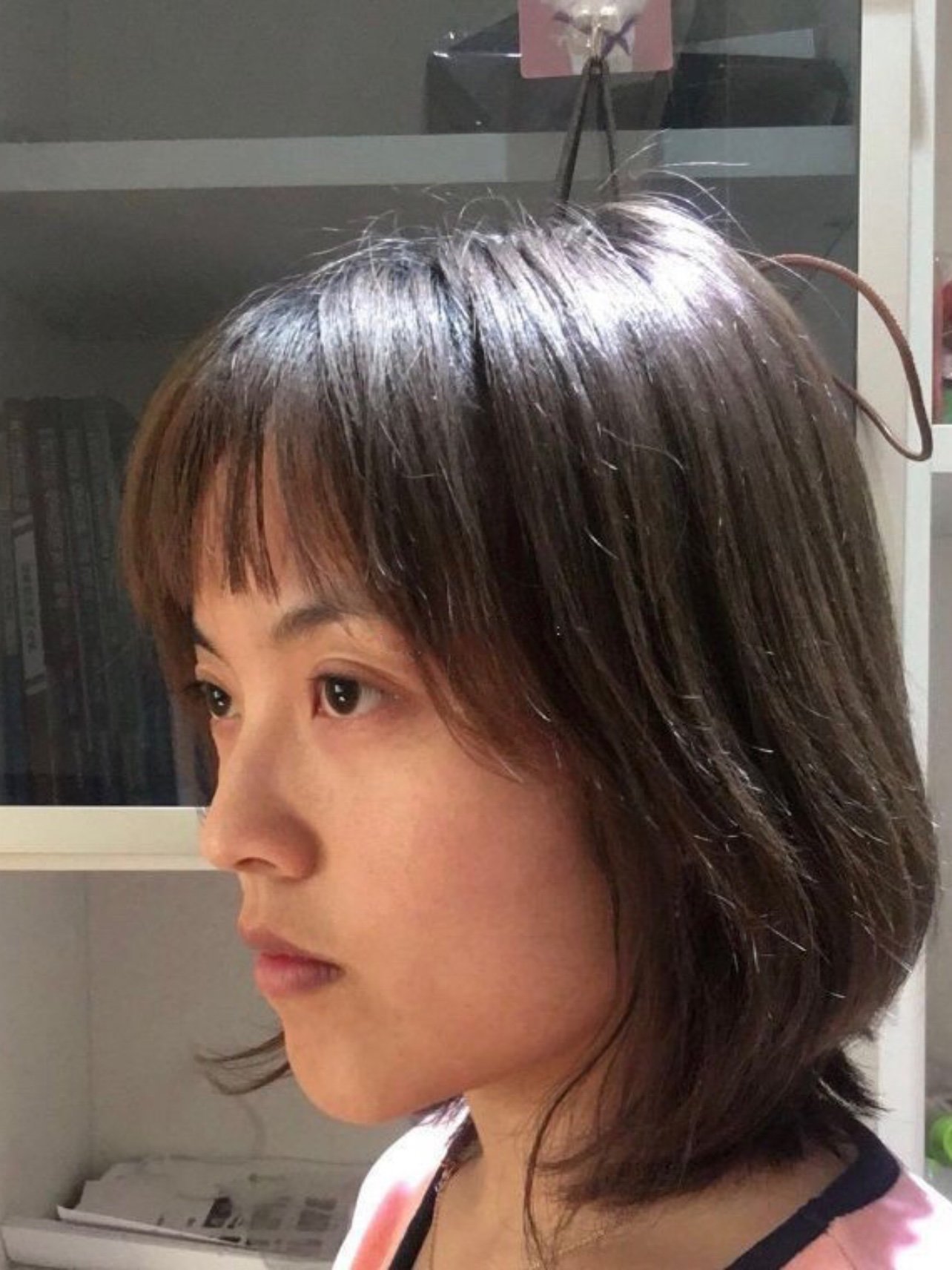 28岁啦,皮肤保养的没有太大问题,脸部轮廓不够明显_圈子-新氧美容整形