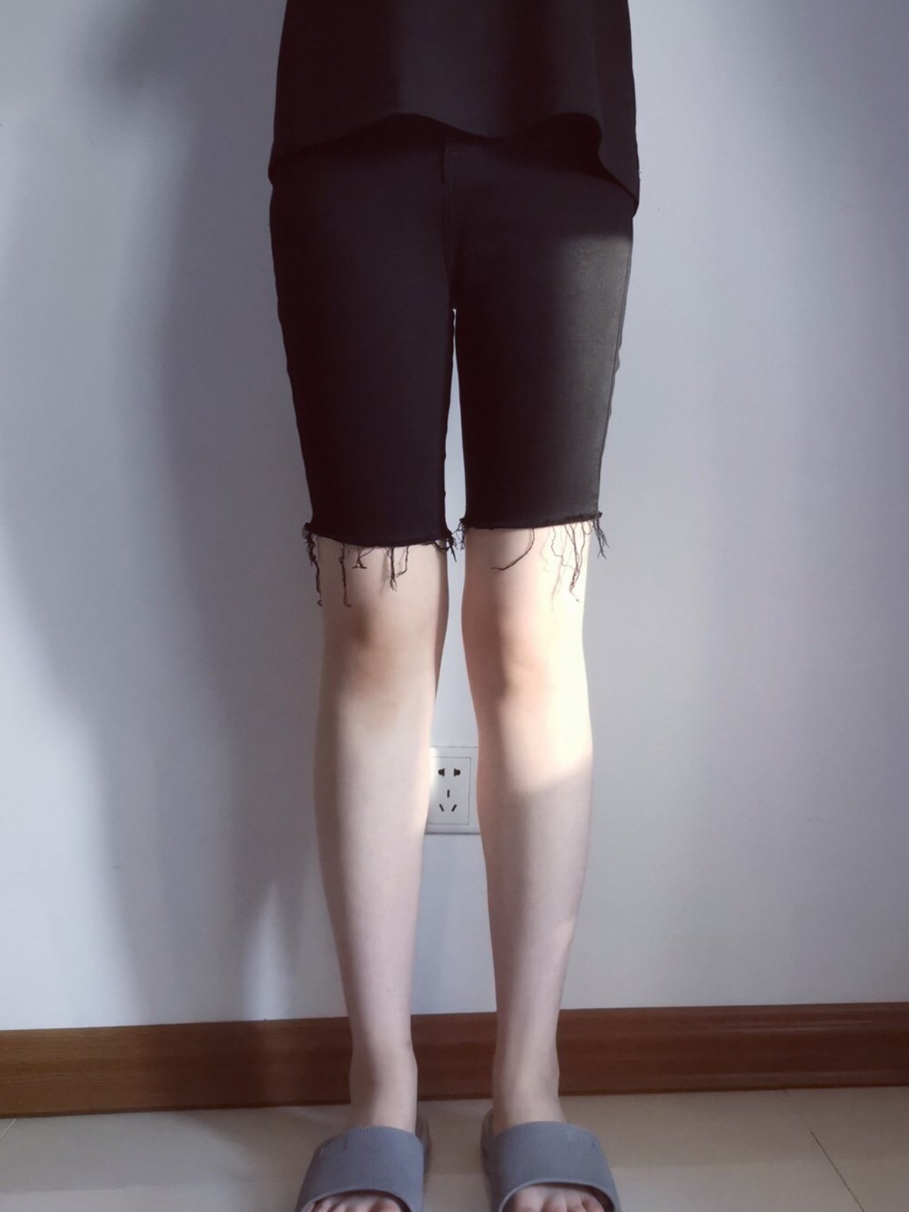 【青岛华颜美-钻石精雕瘦大小腿术后第42天】