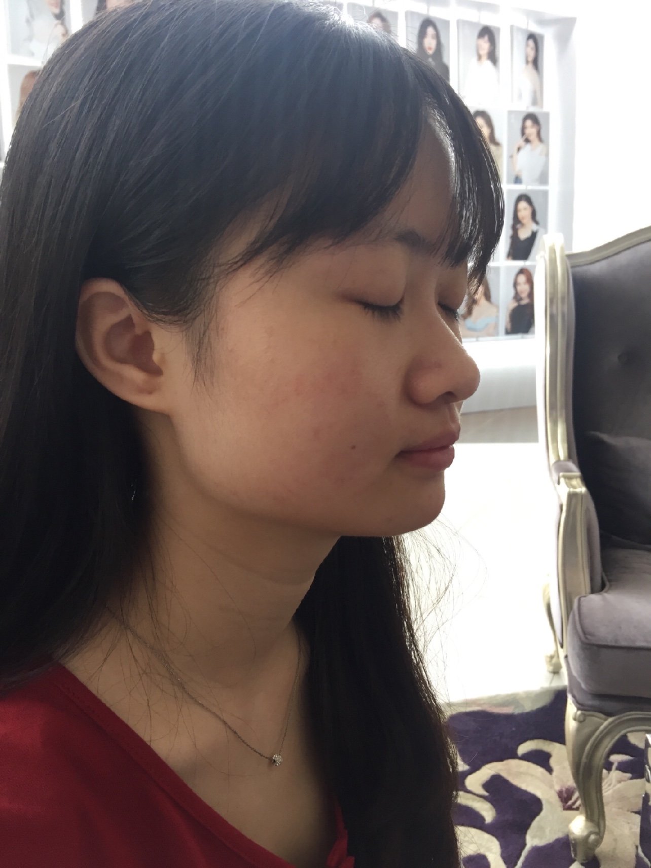 botox瘦咬肌项目术前 仙女们评一下:我这个脸是属于圆脸还是国字脸亦