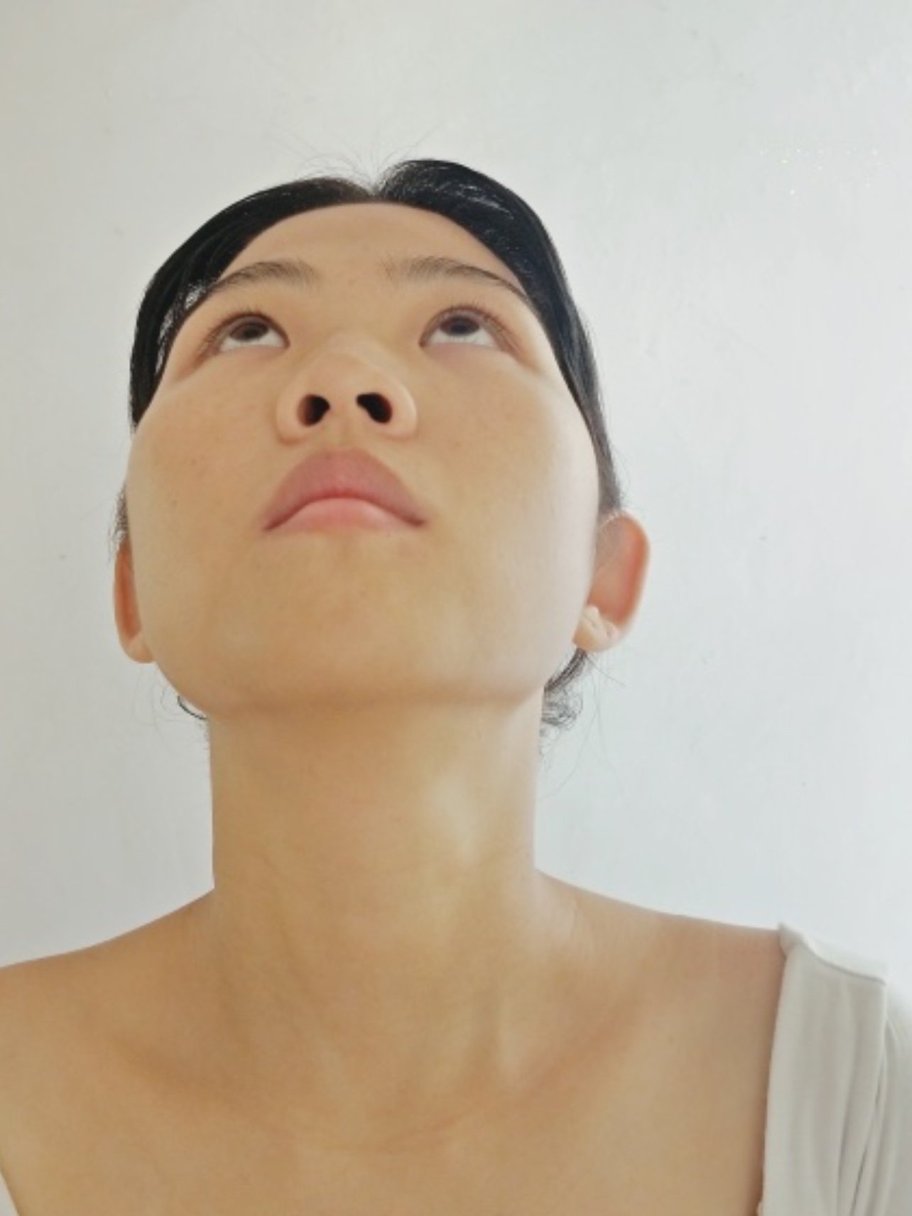 现在下颌缘两侧都有了轮廓感而且皮肤也是很紧致的