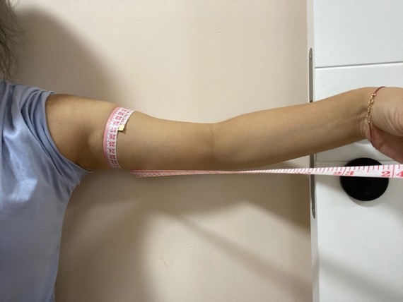 今天是做完酷塑的第八天,量了一下,这几天臂围似乎并_圈子-新氧美容