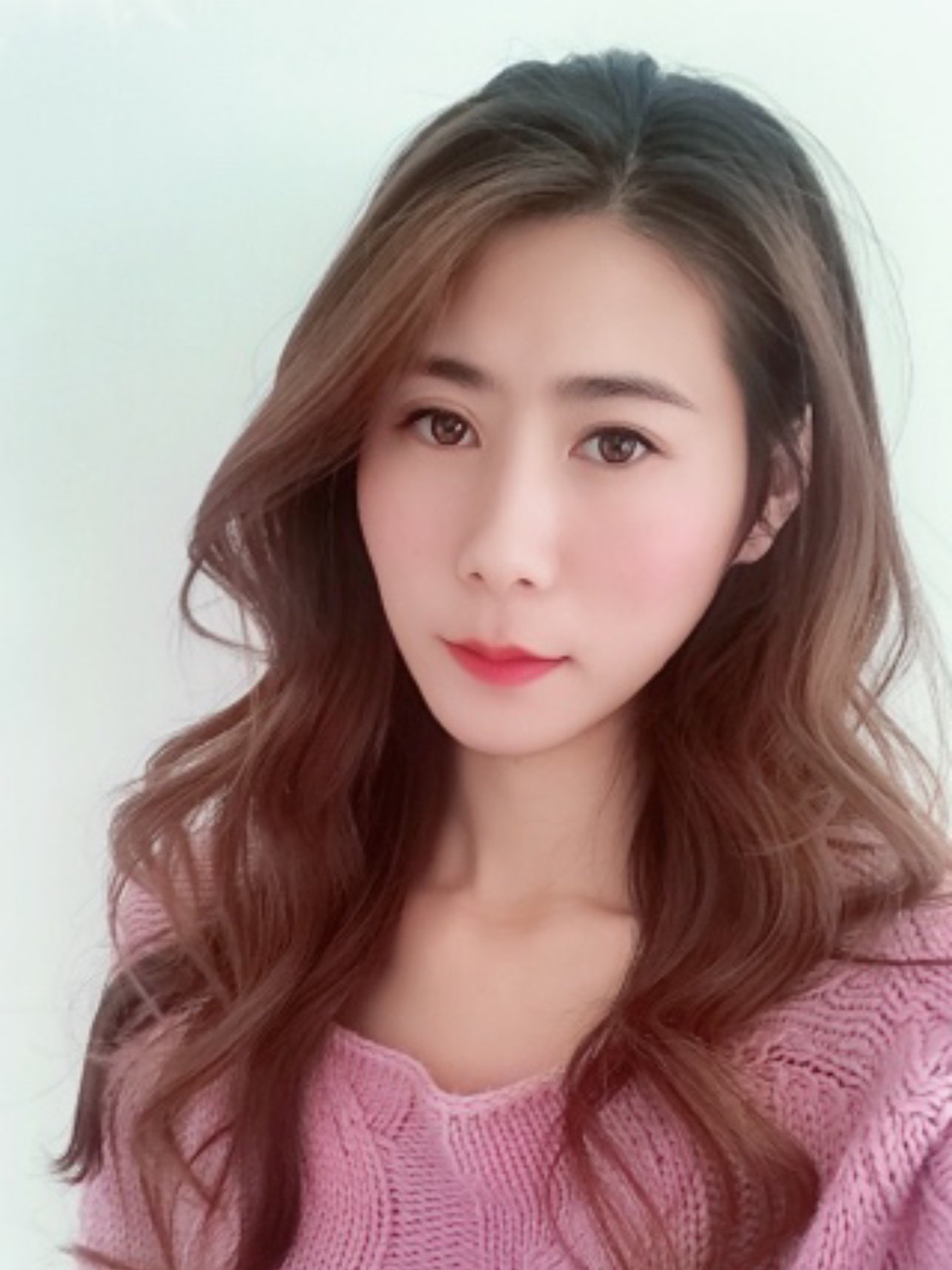 看看我现在的这个小v脸,📥和术前真的是形成了鲜明的_圈子-新氧美容